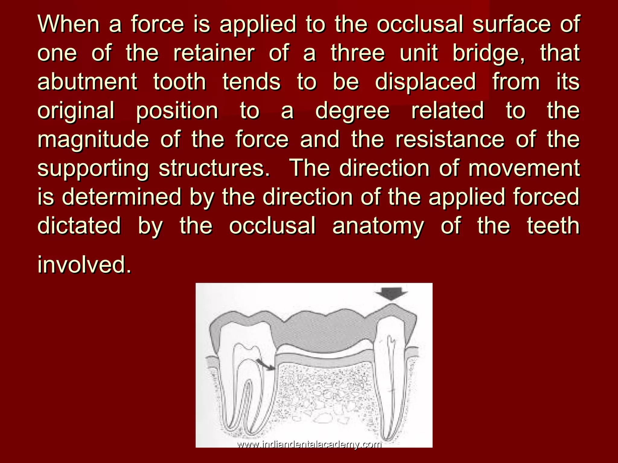 When a force is applied to the occlusal surface of
one of the retainer of a three unit bridge, that
abutment tooth tends to be displaced from its
original position to a degree related to the
magnitude of the force and the resistance of the
supporting structures. The direction of movement
is determined by the direction of the applied forced
dictated by the occlusal anatomy of the teeth
involved.

www.indiandentalacademy.com

 