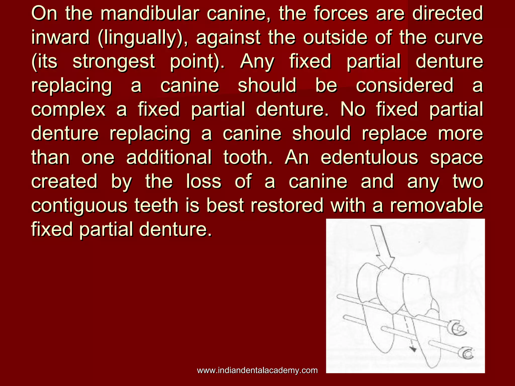 On the mandibular canine, the forces are directed
inward (lingually), against the outside of the curve
(its strongest point). Any fixed partial denture
replacing a canine should be considered a
complex a fixed partial denture. No fixed partial
denture replacing a canine should replace more
than one additional tooth. An edentulous space
created by the loss of a canine and any two
contiguous teeth is best restored with a removable
fixed partial denture.

www.indiandentalacademy.com

 