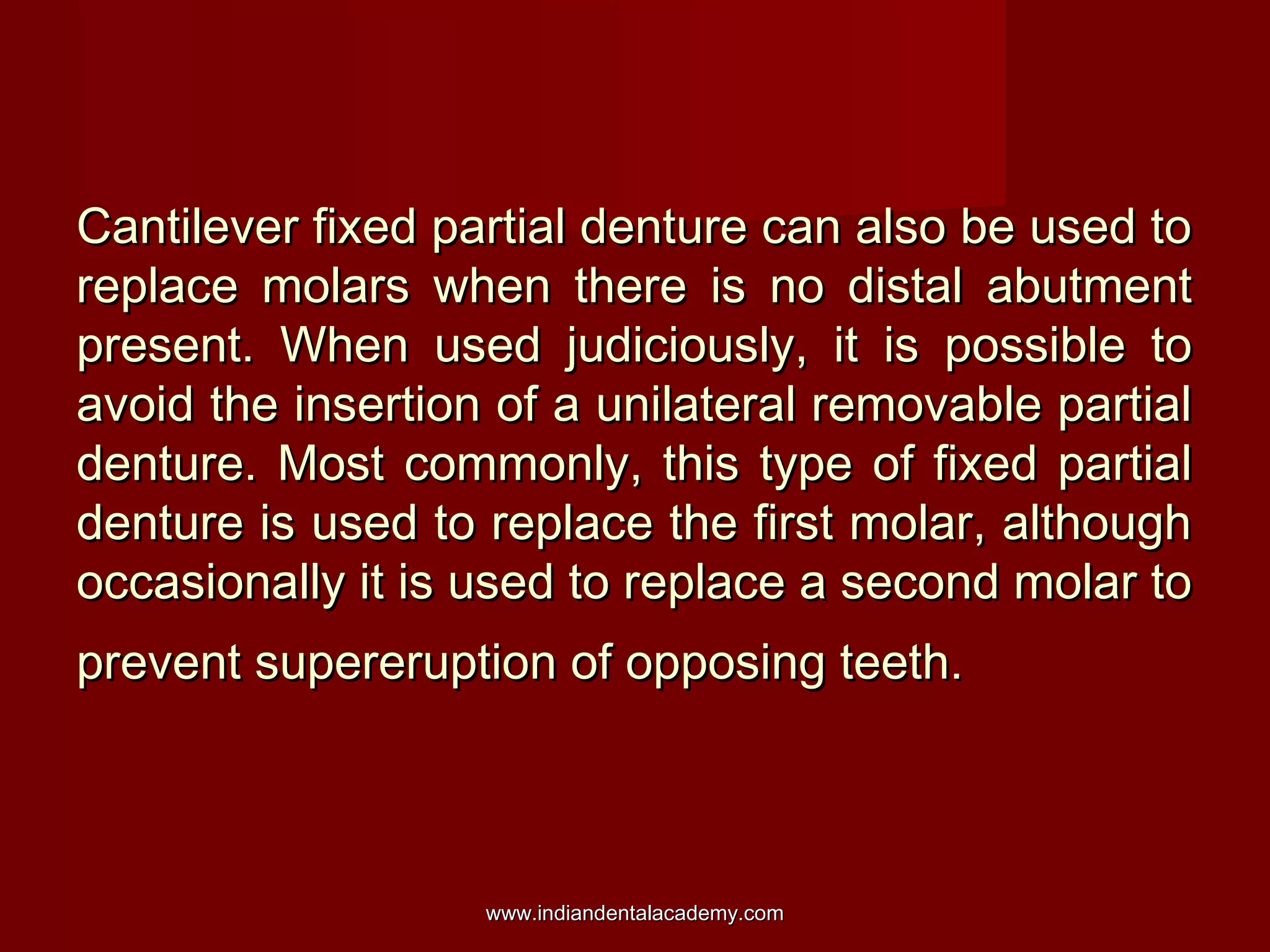 Cantilever fixed partial denture can also be used to
replace molars when there is no distal abutment
present. When used judiciously, it is possible to
avoid the insertion of a unilateral removable partial
denture. Most commonly, this type of fixed partial
denture is used to replace the first molar, although
occasionally it is used to replace a second molar to
prevent supereruption of opposing teeth.

www.indiandentalacademy.com

 