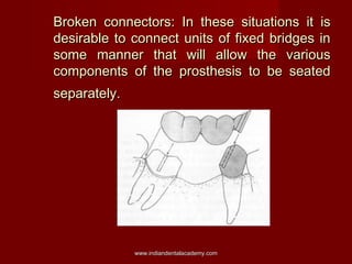Broken connectors: In these situations it is
desirable to connect units of fixed bridges in
some manner that will allow th...