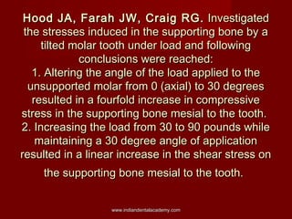 Hood JA, Farah JW, Craig RG. Investigated
the stresses induced in the supporting bone by a
tilted molar tooth under load a...