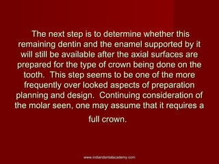 The next step is to determine whether this
remaining dentin and the enamel supported by it
will still be available after t...