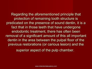 Regarding the aforementioned principle that
protection of remaining tooth structure is
predicated on the presence of sound...