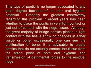 This type of pontic is no longer advocated to any
great degree because of its poor oral hygiene
potential.
Probably the gr...