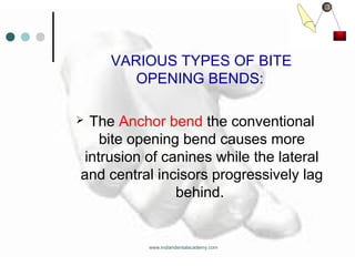 Biomechanics of tooth movement /certified fixed orthodontic courses by Indian dental academy 