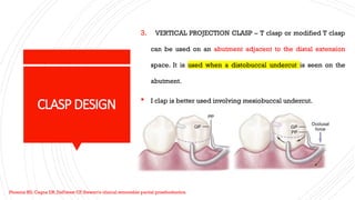 biomechanics in dentistry and applications | PPTX