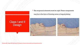 biomechanics in dentistry and applications | PPTX