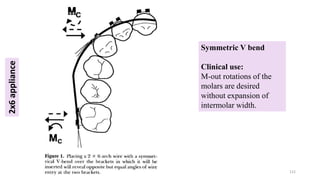 Symmetric V bend
Clinical use:
M-out rotations of the
molars are desired
without expansion of
intermolar width.
2x6
appliance
112
 