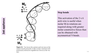 Step bends
This activation of the 2 x 6
arch wire is useful when
molar M-in rotations are
required along with greater
molar constrictive forces than
can be obtained with
asymmetrical V-bends.
118
2x6
appliance
 