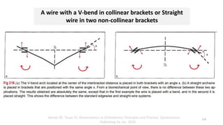 A wire with a V-bend in collinear brackets or Straight
wire in two non-collinear brackets
119
Nanda RS, Tosun YS. Biomechanics in Orthodontics Principles and Practice. Quintessence
Publishing Co, Inc. 2019.
 