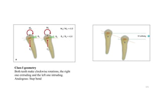 Class I geometry
Both teeth make clockwise rotations, the right
one extruding and the left one intruding.
Analogous- Step bend
121
 