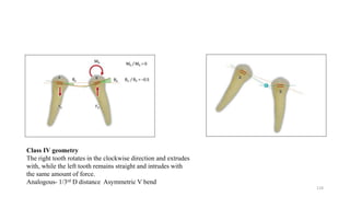 Class IV geometry
The right tooth rotates in the clockwise direction and extrudes
with, while the left tooth remains straight and intrudes with
the same amount of force.
Analogous- 1/3rd D distance Asymmetric V bend
124
 