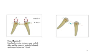 Class VI geometry
Equal and opposite moments occur on both
sides, and the system is statically balanced.
Analogous- Symmetric V bend
126
 