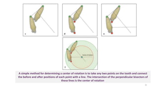A simple method for determining a center of rotation is to take any two points on the tooth and connect
the before and after positions of each point with a line. The intersection of the perpendicular bisectors of
these lines is the center of rotation
32
 