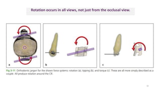 Rotation occurs in all views, not just from the occlusal view.
42
 