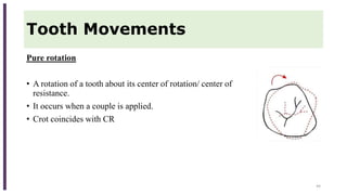 Tooth Movements
Pure rotation
• A rotation of a tooth about its center of rotation/ center of
resistance.
• It occurs when a couple is applied.
• Crot coincides with CR
44
 