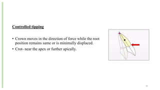 Controlled tipping
• Crown moves in the direction of force while the root
position remains same or is minimally displaced.
• Crot- near the apex or further apically.
46
 