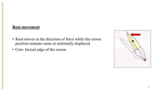Root movement
• Root moves in the dierction of force while the crown
position remains same or minimally displaced.
• Crot- Incisal edge of the crown.
48
 