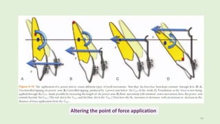 50
Altering the point of force application
 