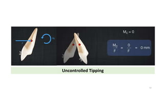 Uncontrolled Tipping
52
 