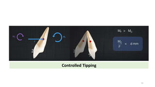 Controlled Tipping
53
 