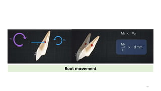 Root movement
55
 