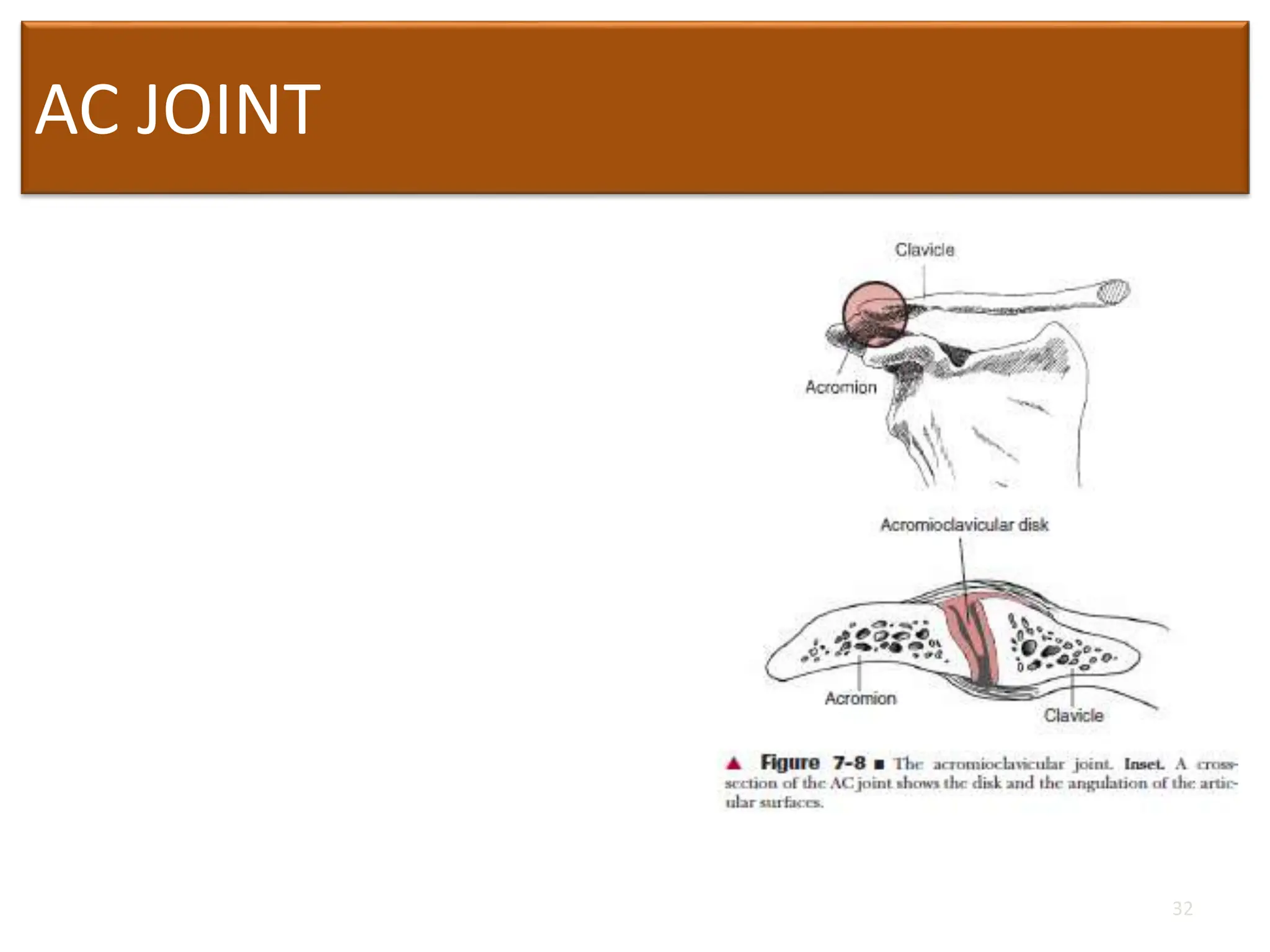 AC JOINT
• Lateral end of clavicle with
acromion process of scapula
• Weak joint and susceptible
to sprain and separation
• Joint capsule n two major
ligaments and disk – present
or absent
32
 