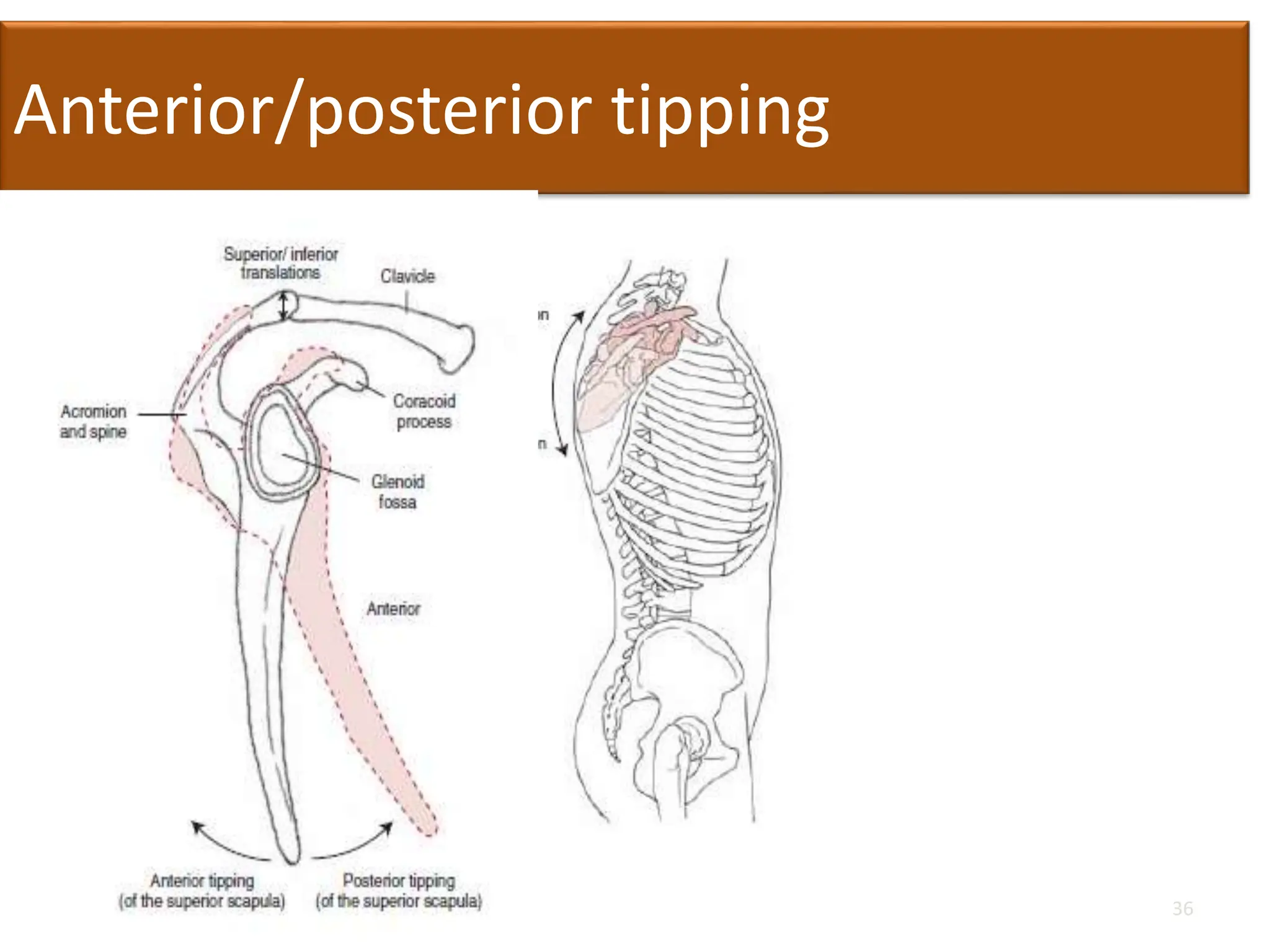 Anterior/posterior tipping
36
 