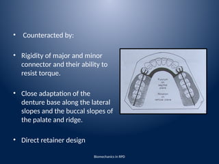 Open Palatal Rpd biomechanics of removable partial denture | PPTX
