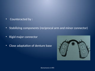 biomechanics of removable partial denture | PPTX