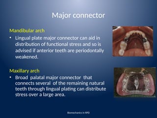 biomechanics of removable partial denture | PPTX