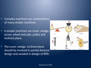 Novafav Machine Rpd biomechanics of removable partial denture | PPTX