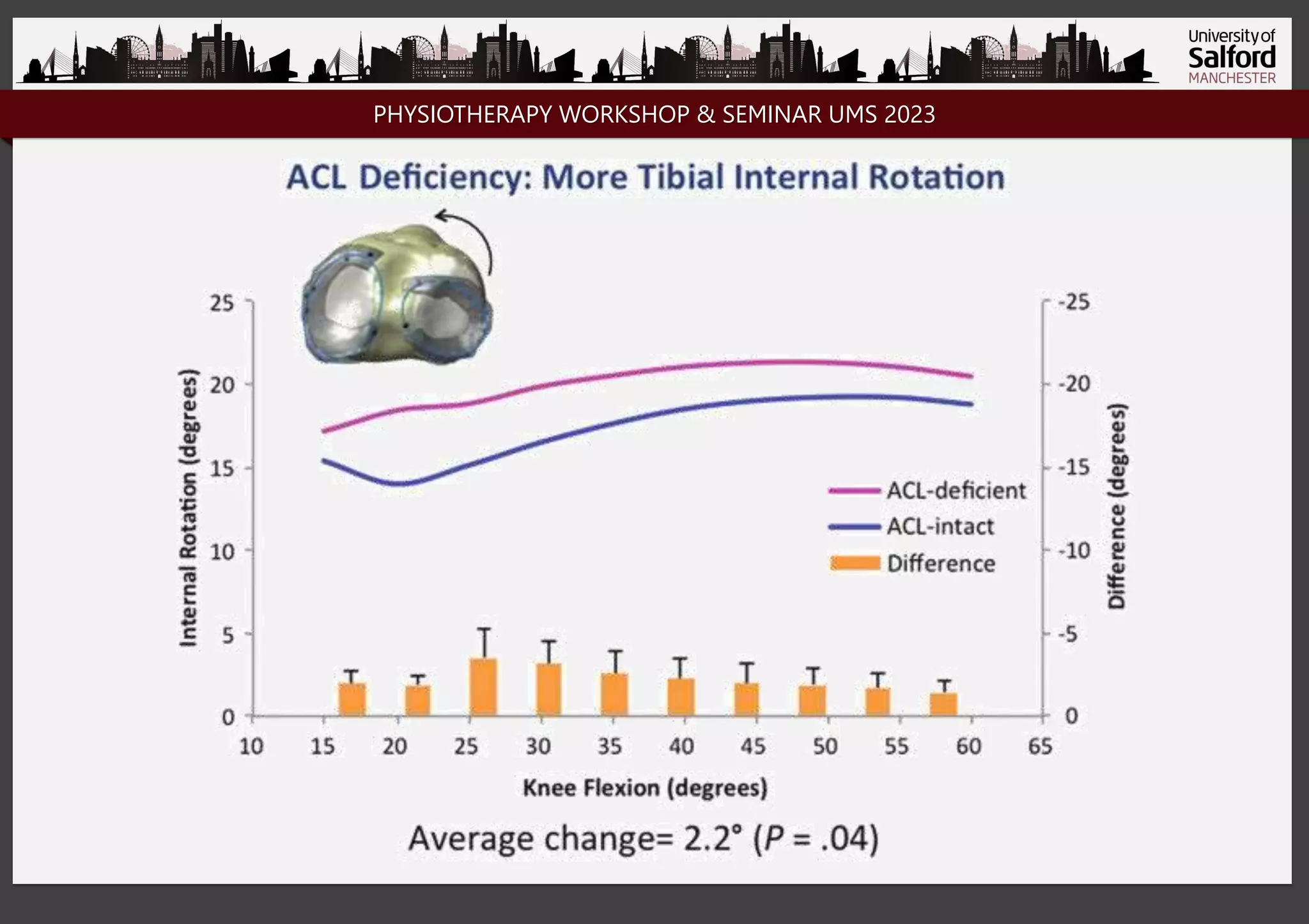 Biomechanics ACL.pptx