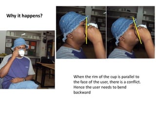 Biomechanics in cup handle design | PDF