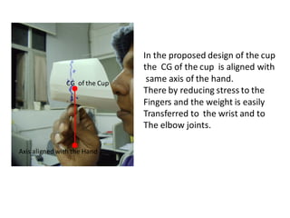 Biomechanics in cup handle design | PDF