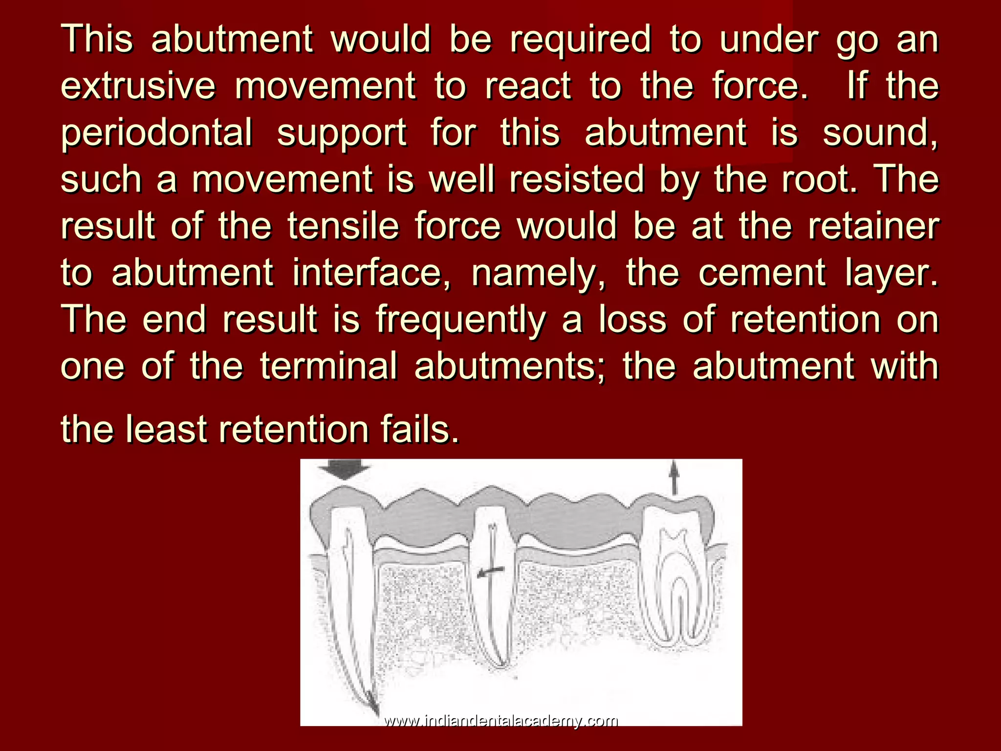 This abutment would be required to under go anThis abutment would be required to under go an
extrusive movement to react to the force. If theextrusive movement to react to the force. If the
periodontal support for this abutment is sound,periodontal support for this abutment is sound,
such a movement is well resisted by the root. Thesuch a movement is well resisted by the root. The
result of the tensile force would be at the retainerresult of the tensile force would be at the retainer
to abutment interface, namely, the cement layer.to abutment interface, namely, the cement layer.
The end result is frequently a loss of retention onThe end result is frequently a loss of retention on
one of the terminal abutments; the abutment withone of the terminal abutments; the abutment with
the least retention fails.the least retention fails.
www.indiandentalacademy.comwww.indiandentalacademy.com
 