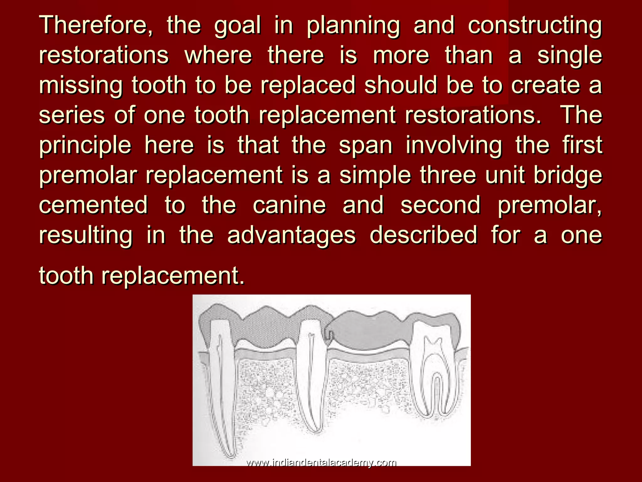 Therefore, the goal in planning and constructingTherefore, the goal in planning and constructing
restorations where there is more than a singlerestorations where there is more than a single
missing tooth to be replaced should be to create amissing tooth to be replaced should be to create a
series of one tooth replacement restorations. Theseries of one tooth replacement restorations. The
principle here is that the span involving the firstprinciple here is that the span involving the first
premolar replacement is a simple three unit bridgepremolar replacement is a simple three unit bridge
cemented to the canine and second premolar,cemented to the canine and second premolar,
resulting in the advantages described for a oneresulting in the advantages described for a one
tooth replacement.tooth replacement.
www.indiandentalacademy.comwww.indiandentalacademy.com
 