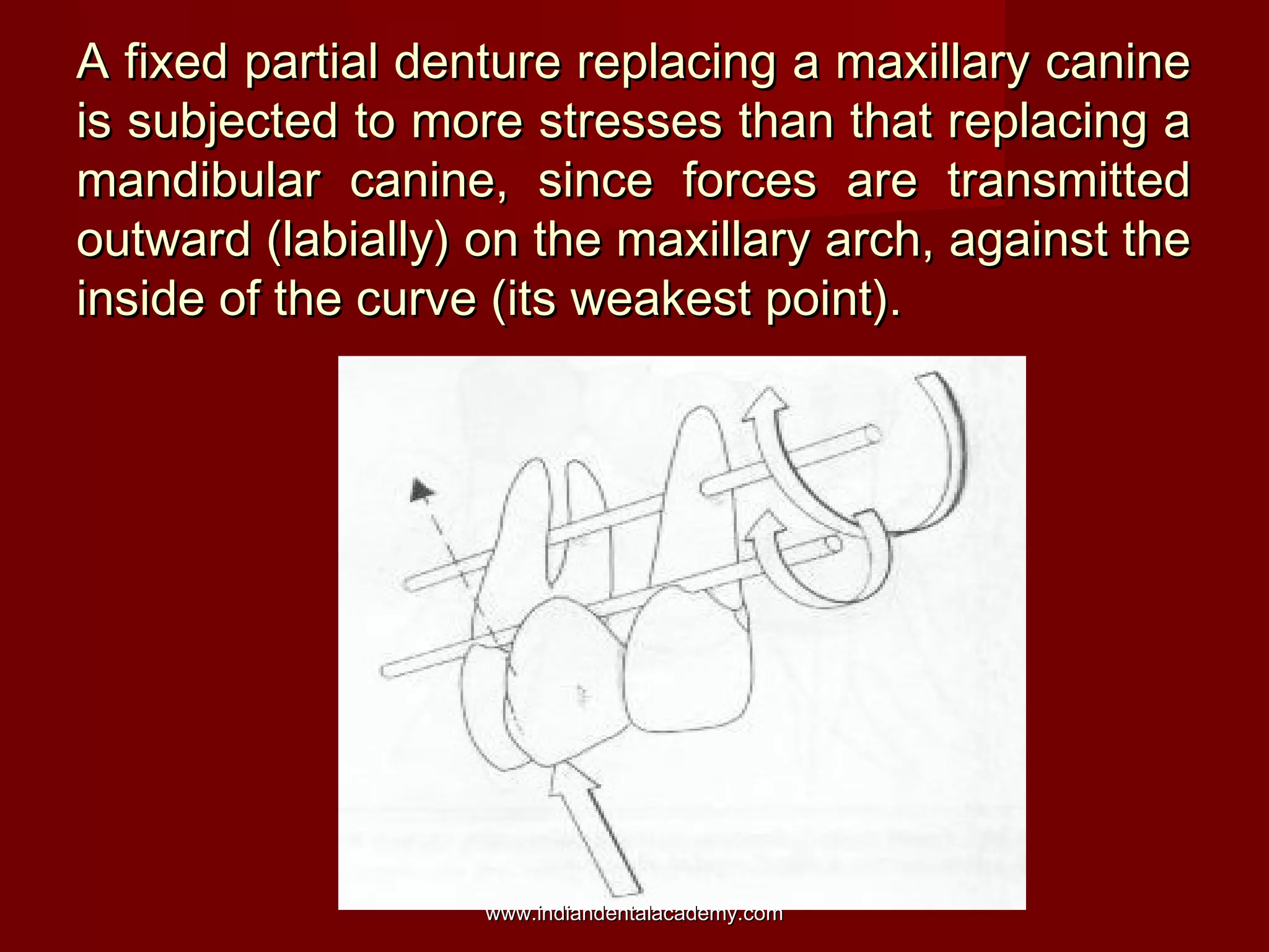 A fixed partial denture replacing a maxillary canineA fixed partial denture replacing a maxillary canine
is subjected to more stresses than that replacing ais subjected to more stresses than that replacing a
mandibular canine, since forces are transmittedmandibular canine, since forces are transmitted
outward (labially) on the maxillary arch, against theoutward (labially) on the maxillary arch, against the
inside of the curve (its weakest point).inside of the curve (its weakest point).
www.indiandentalacademy.comwww.indiandentalacademy.com
 