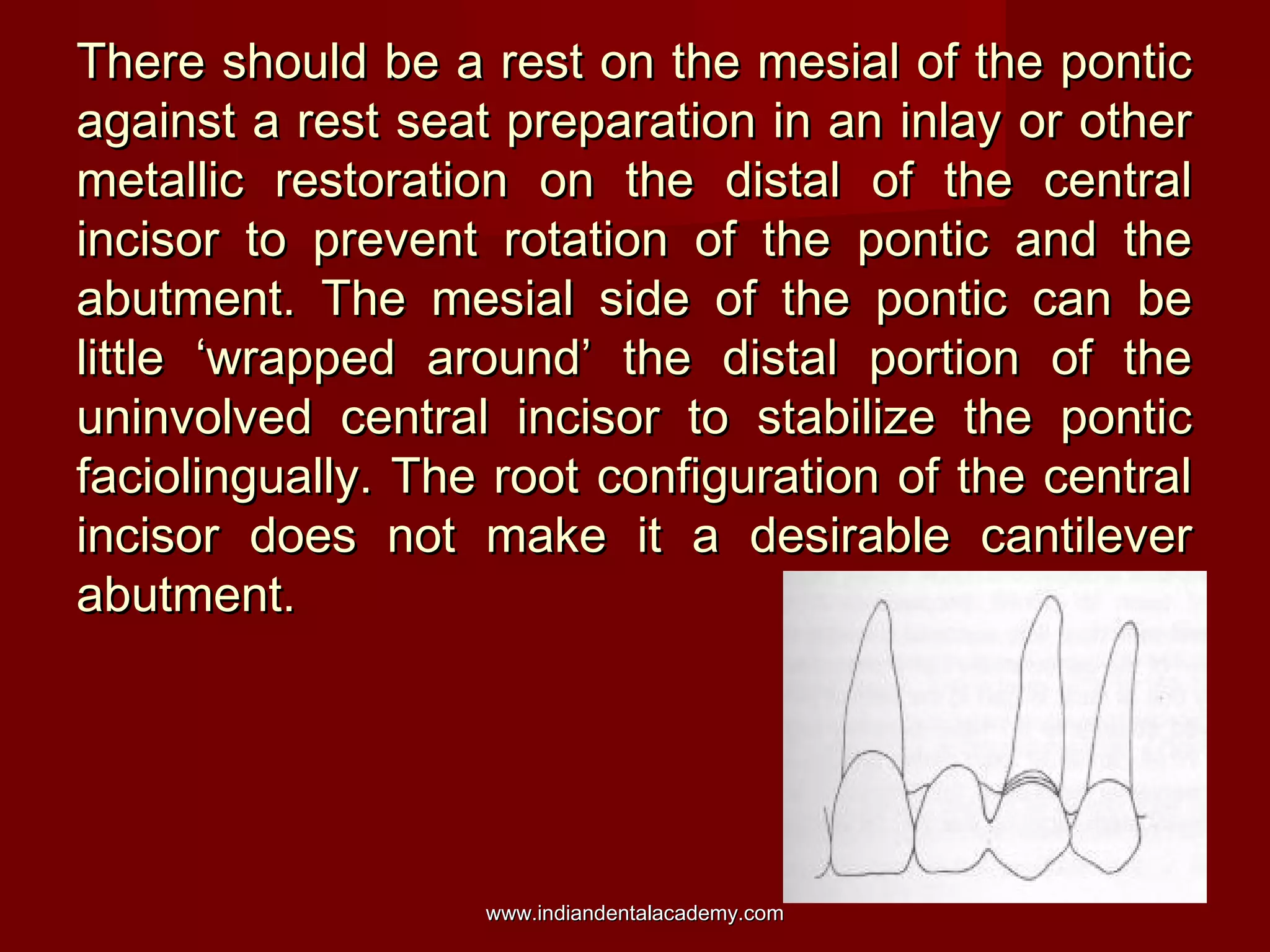 There should be a rest on the mesial of the ponticThere should be a rest on the mesial of the pontic
against a rest seat preparation in an inlay or otheragainst a rest seat preparation in an inlay or other
metallic restoration on the distal of the centralmetallic restoration on the distal of the central
incisor to prevent rotation of the pontic and theincisor to prevent rotation of the pontic and the
abutment. The mesial side of the pontic can beabutment. The mesial side of the pontic can be
little ‘wrapped around’ the distal portion of thelittle ‘wrapped around’ the distal portion of the
uninvolved central incisor to stabilize the ponticuninvolved central incisor to stabilize the pontic
faciolingually. The root configuration of the centralfaciolingually. The root configuration of the central
incisor does not make it a desirable cantileverincisor does not make it a desirable cantilever
abutment.abutment.
www.indiandentalacademy.comwww.indiandentalacademy.com
 