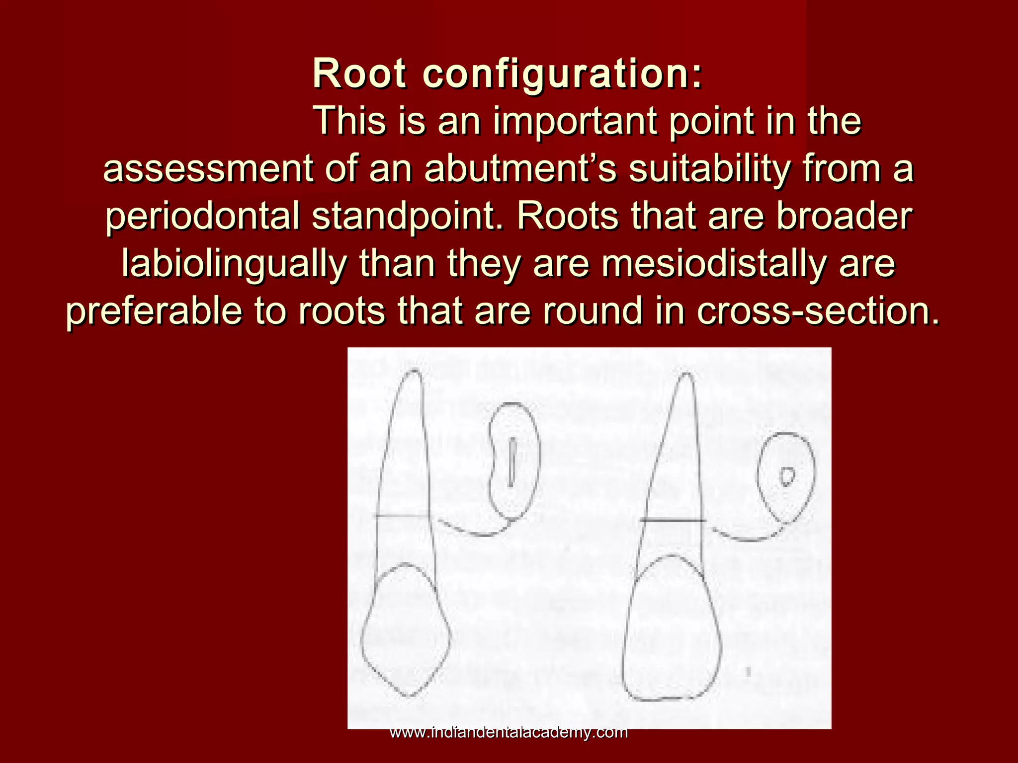 Root configuration:Root configuration:
This is an important point in theThis is an important point in the
assessment of an abutment’s suitability from aassessment of an abutment’s suitability from a
periodontal standpoint. Roots that are broaderperiodontal standpoint. Roots that are broader
labiolingually than they are mesiodistally arelabiolingually than they are mesiodistally are
preferable to roots that are round in cross-section.preferable to roots that are round in cross-section.
www.indiandentalacademy.comwww.indiandentalacademy.com
 