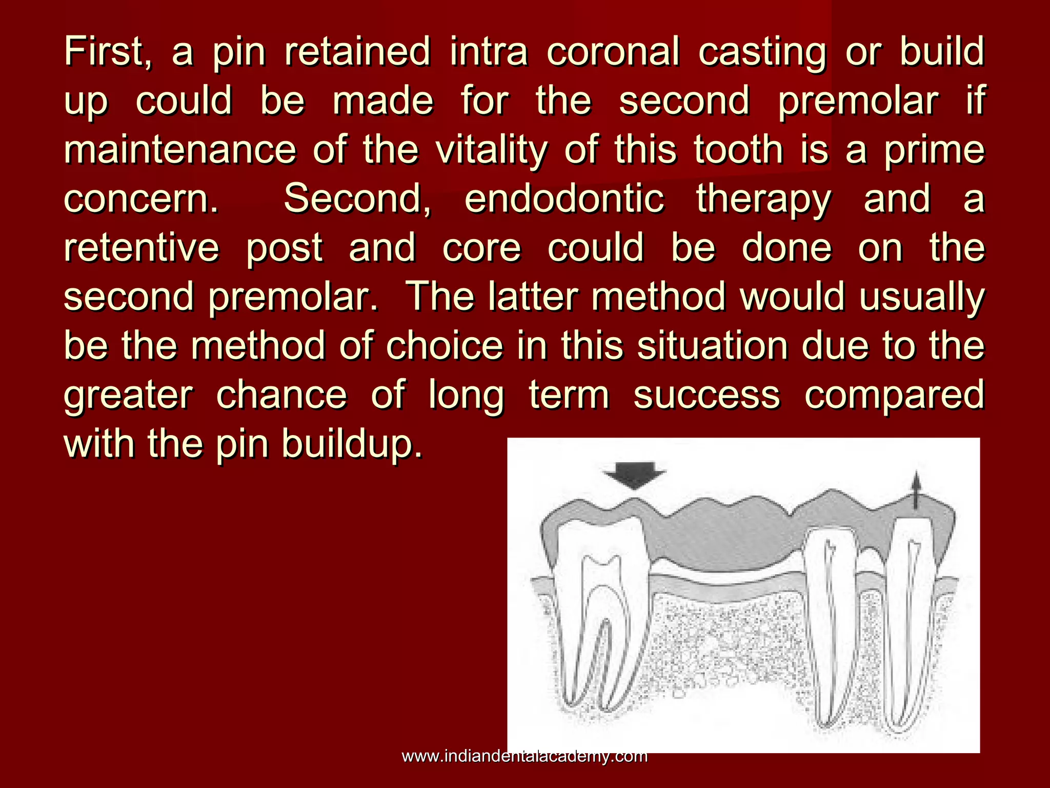 First, a pin retained intra coronal casting or buildFirst, a pin retained intra coronal casting or build
up could be made for the second premolar ifup could be made for the second premolar if
maintenance of the vitality of this tooth is a primemaintenance of the vitality of this tooth is a prime
concern. Second, endodontic therapy and aconcern. Second, endodontic therapy and a
retentive post and core could be done on theretentive post and core could be done on the
second premolar. The latter method would usuallysecond premolar. The latter method would usually
be the method of choice in this situation due to thebe the method of choice in this situation due to the
greater chance of long term success comparedgreater chance of long term success compared
with the pin buildup.with the pin buildup.
www.indiandentalacademy.comwww.indiandentalacademy.com
 