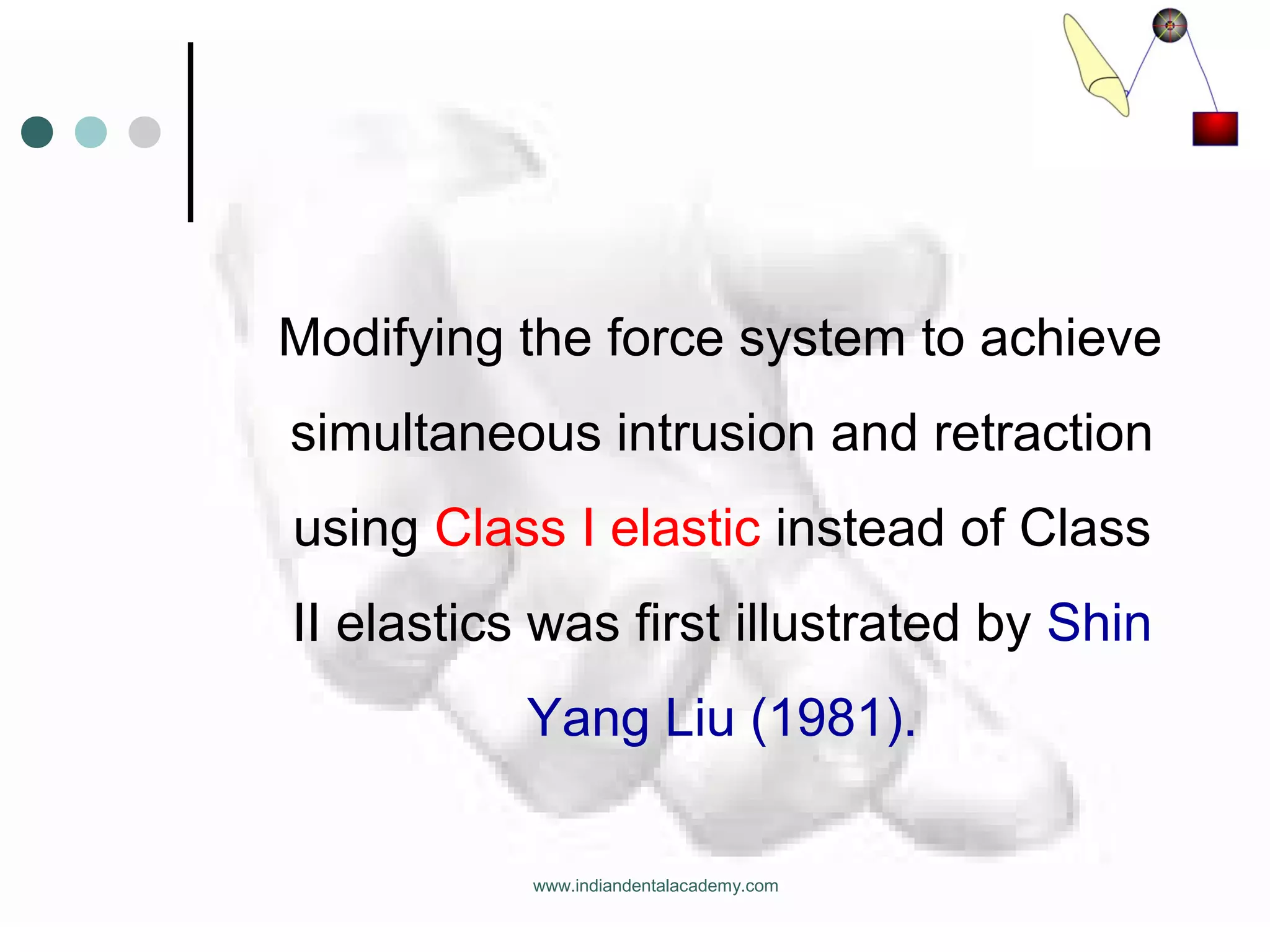 Modifying the force system to achieve
simultaneous intrusion and retraction
using Class I elastic instead of Class
II elastics was first illustrated by Shin
Yang Liu (1981).
www.indiandentalacademy.com
 