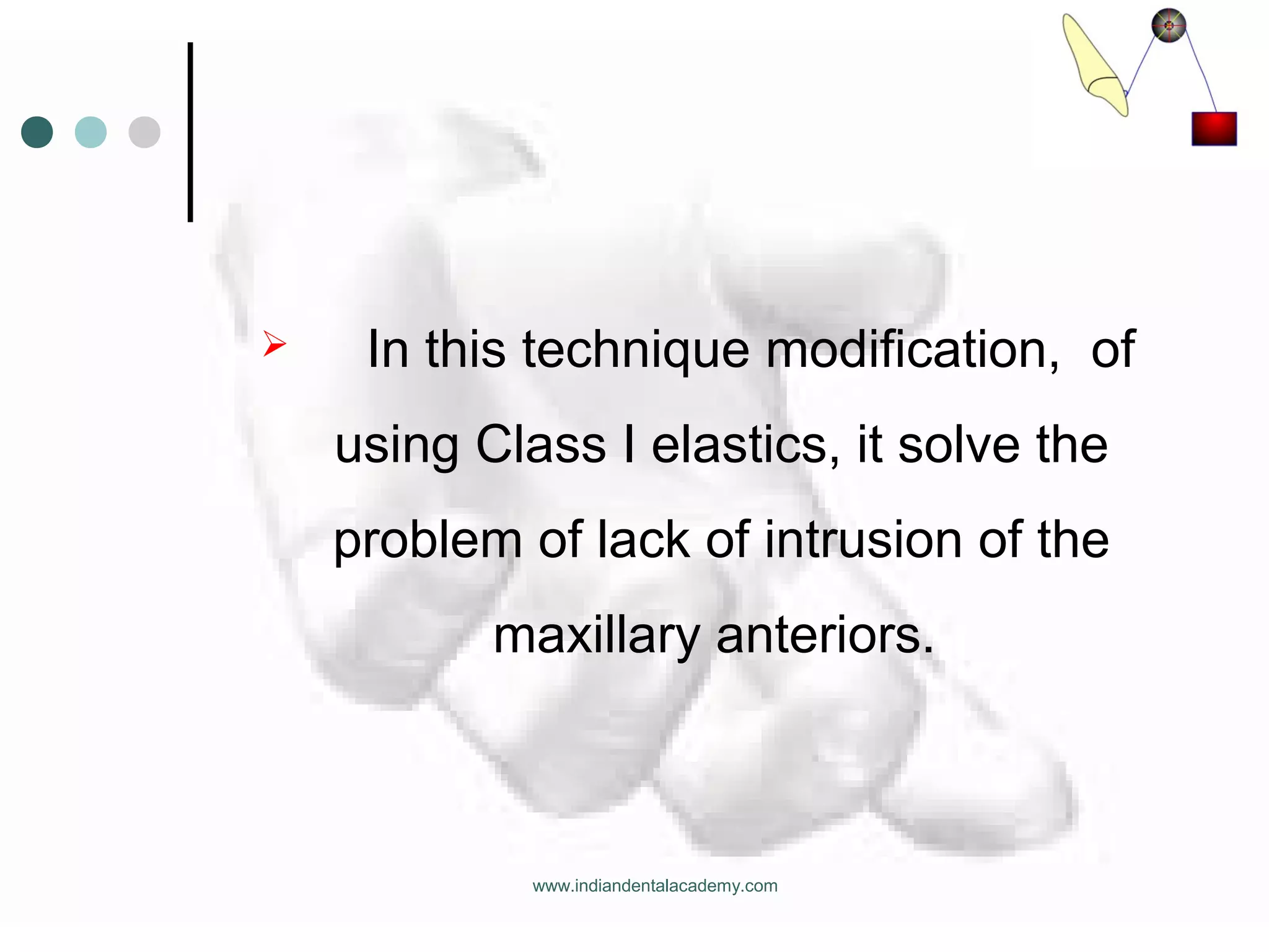  In this technique modification, of
using Class I elastics, it solve the
problem of lack of intrusion of the
maxillary anteriors.
www.indiandentalacademy.com
 