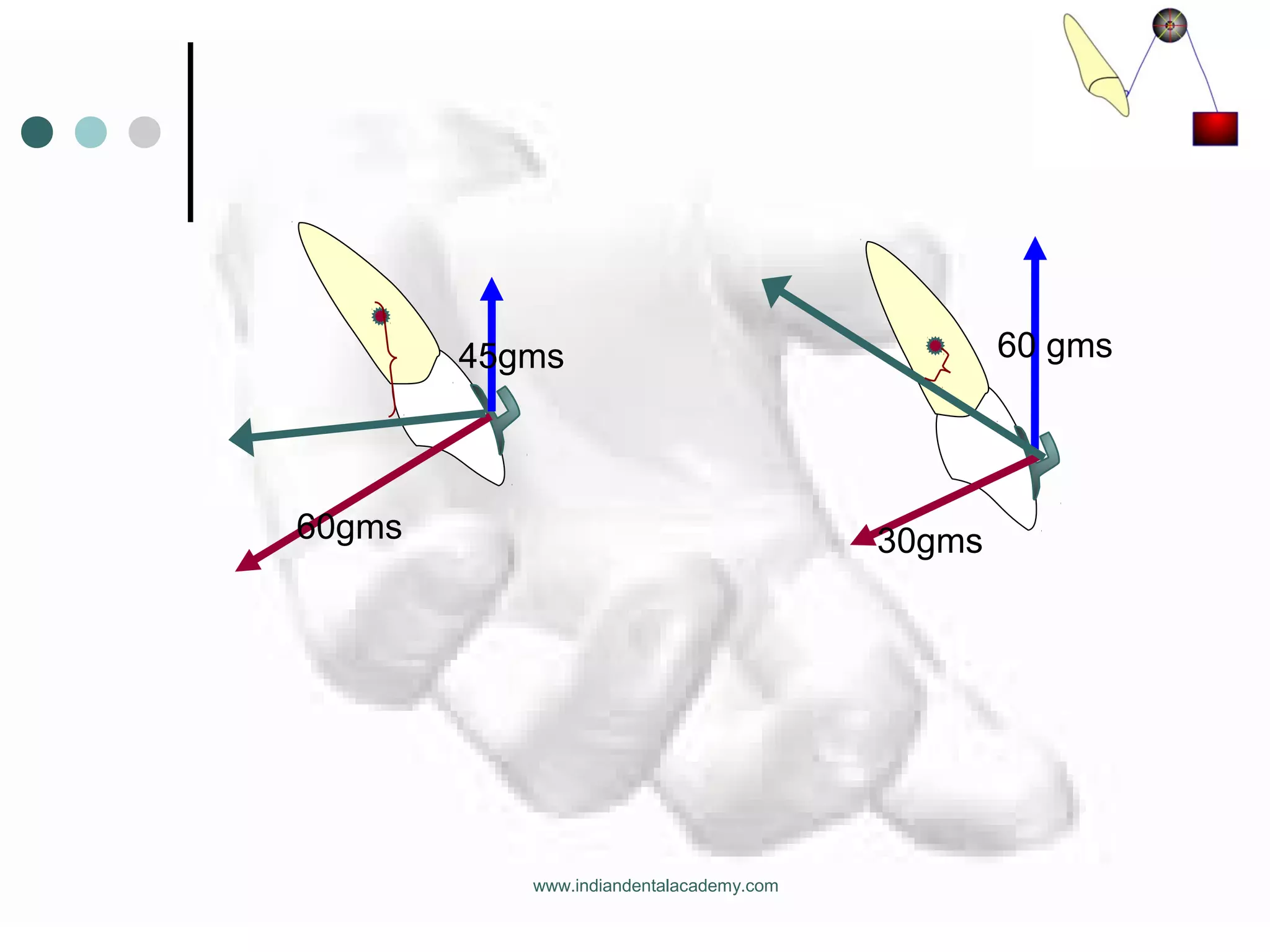 45gms
60gms
60 gms
30gms
www.indiandentalacademy.com
 