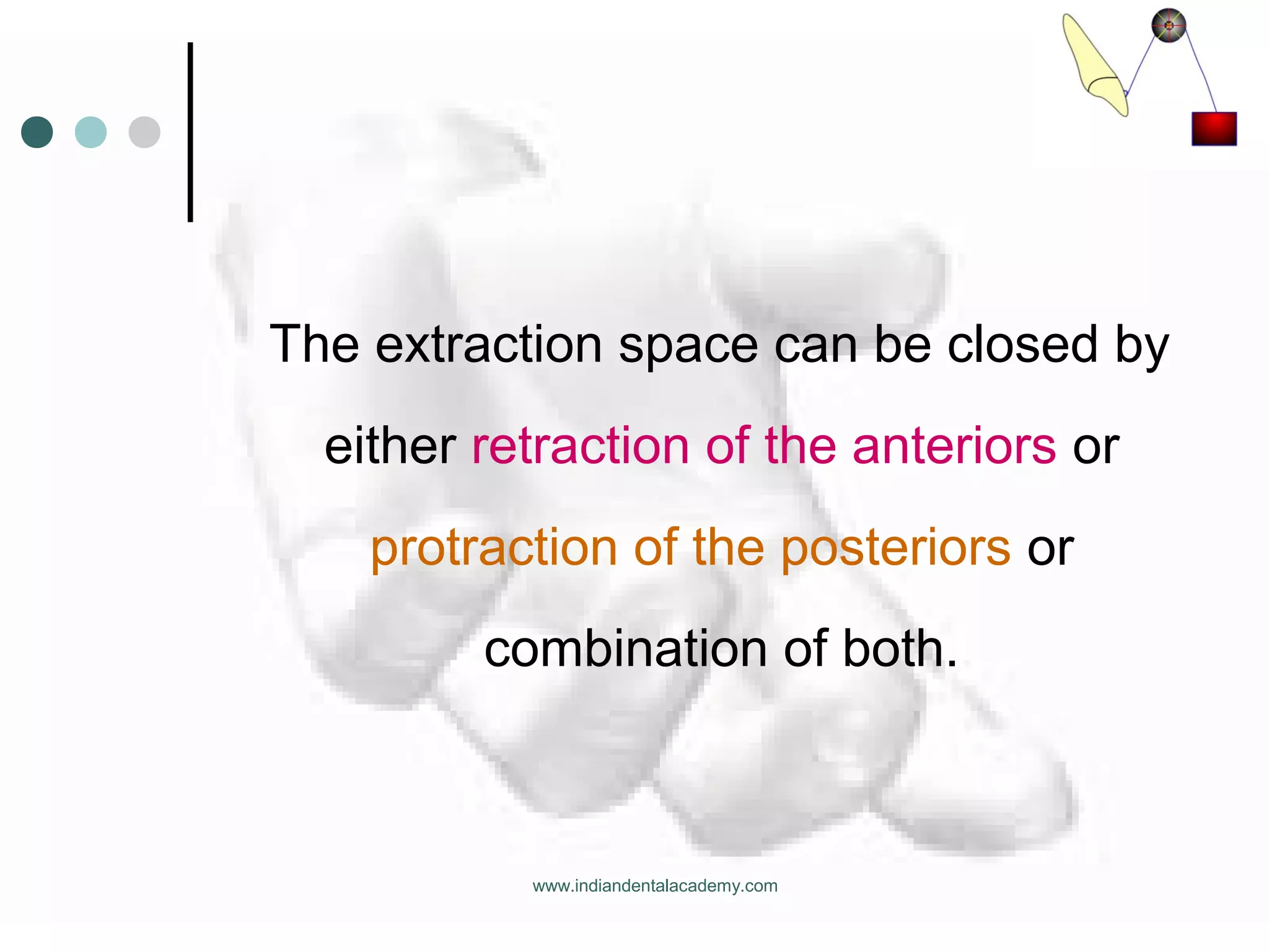 The extraction space can be closed by
either retraction of the anteriors or
protraction of the posteriors or
combination of both.
www.indiandentalacademy.com
 