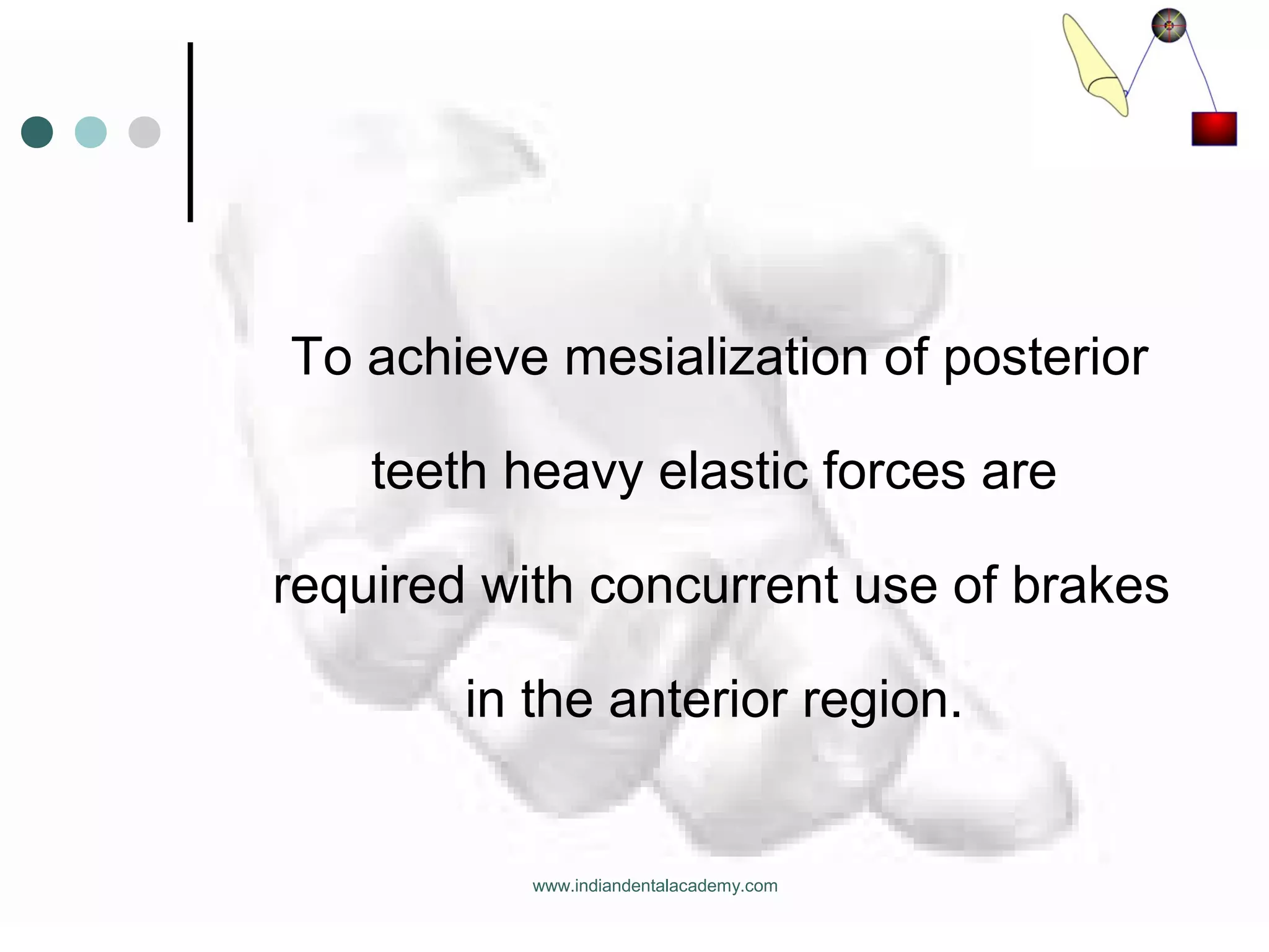 To achieve mesialization of posterior
teeth heavy elastic forces are
required with concurrent use of brakes
in the anterior region.
www.indiandentalacademy.com
 