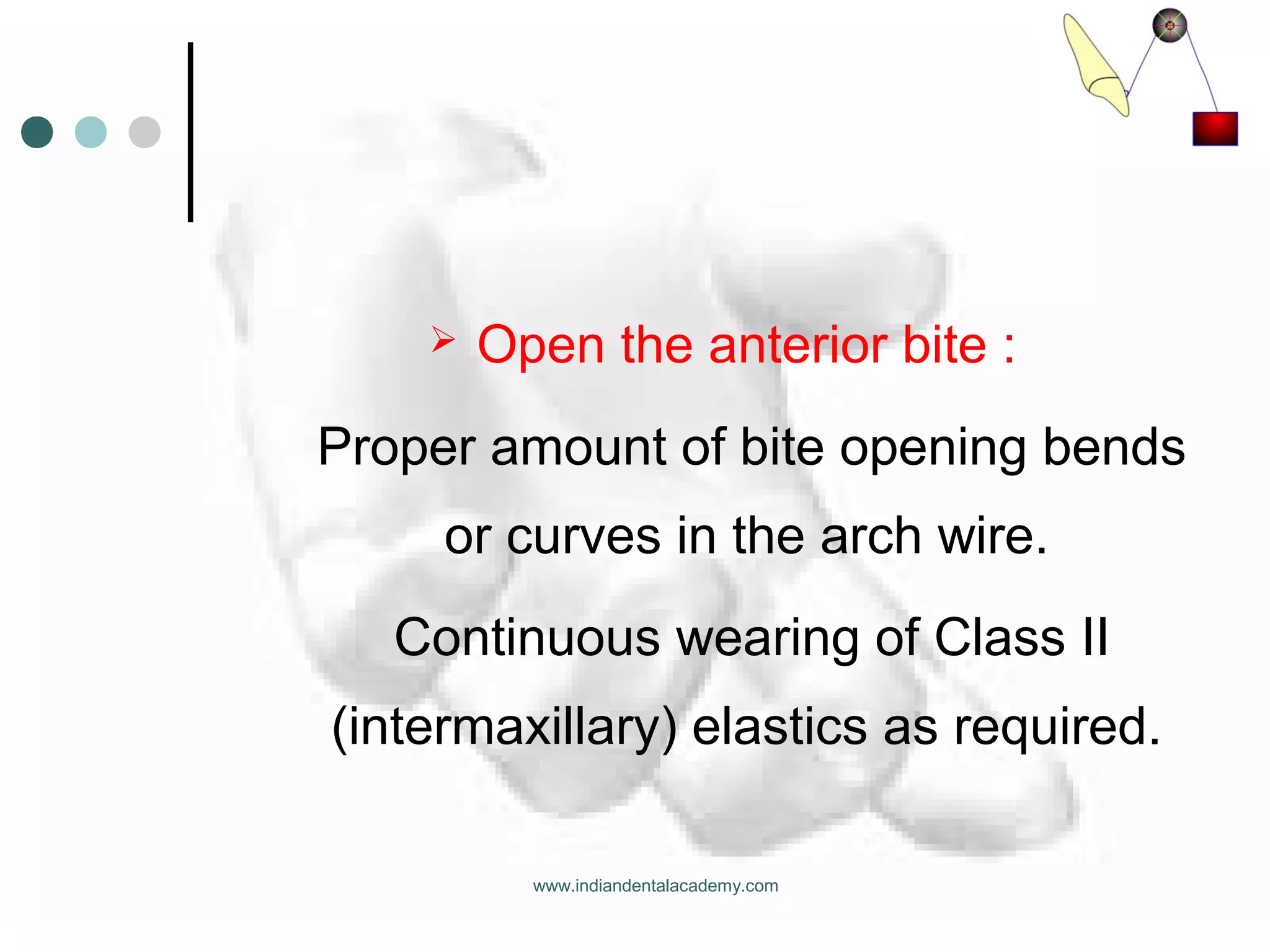  Open the anterior bite :
Proper amount of bite opening bends
or curves in the arch wire.
Continuous wearing of Class II
(intermaxillary) elastics as required.
www.indiandentalacademy.com
 