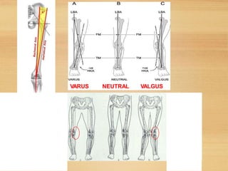 Biomechanics of knee | PPT