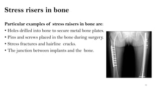 Biomechanics of bones PDF | PDF