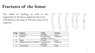 Biomechanics of bones PDF | PDF